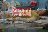 Vợ chồng thầy giáo bỏng nặng sau trận "tỉ thí" bằng lửa Vợ chồng thầy giáo bỏng nặng sau trận "tỉ thí" bằng lửa