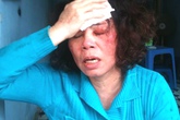 Nghi án 4 cháu gái 'xử' bác chồng theo kiểu côn đồ Nghi án 4 cháu gái 'xử' bác chồng theo kiểu côn đồ