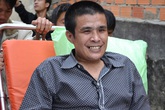 Người có khối u khổng lồ ở chân đã qua đời Người có khối u khổng lồ ở chân đã qua đời