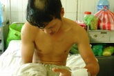 Bị giang hồ truy sát nhầm, nam công nhân gần đứt lìa tay Bị giang hồ truy sát nhầm, nam công nhân gần đứt lìa tay