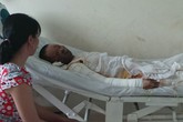 Mồi thuốc lá bên chai cồn, hai vợ chồng bỏng nặng Mồi thuốc lá bên chai cồn, hai vợ chồng bỏng nặng