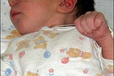Những em bé có hai bộ phận sinh dục Những em bé có hai bộ phận sinh dục