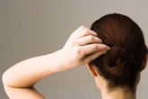 Nguyên nhân khiến bạn bạc tóc sớm Nguyên nhân khiến bạn bạc tóc sớm