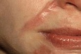 Thực hư vụ nữ sinh "bị rạch mặt" Thực hư vụ nữ sinh "bị rạch mặt"