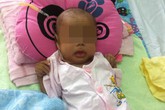 Cứu thành công bé sơ sinh bị hỏng gần hết ruột Cứu thành công bé sơ sinh bị hỏng gần hết ruột