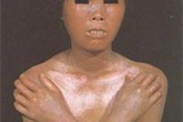 Quý bà thất kinh vì "hóa đá" Quý bà thất kinh vì "hóa đá"