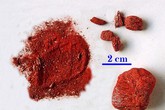 Bé trai 7 tháng bị ngộ độc thần sa Bé trai 7 tháng bị ngộ độc thần sa