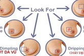 Nhận dạng những dấu hiệu bất thường ở ngực Nhận dạng những dấu hiệu bất thường ở ngực
