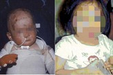 Cha mẹ nghiện ma túy, con chết thảm Cha mẹ nghiện ma túy, con chết thảm