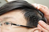 Món ăn bài thuốc chữa chứng tóc bạc sớm Món ăn bài thuốc chữa chứng tóc bạc sớm
