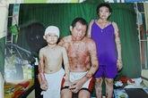 Nỗi đau thấu trời của gia đình "a-xít" Nỗi đau thấu trời của gia đình "a-xít"