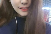 Gái Hàn quay cuồng với mốt phẫu thuật "môi cười" Gái Hàn quay cuồng với mốt phẫu thuật "môi cười"