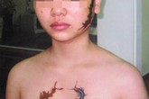 Những bất thường trong vụ án thiếu nữ bị xăm rết lên mặt Những bất thường trong vụ án thiếu nữ bị xăm rết lên mặt