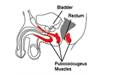 Bài tập Kegel giúp "chuyện ấy" thăng hoa Bài tập Kegel giúp "chuyện ấy" thăng hoa