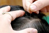 Đoán sức khỏe qua vị trí tóc bạc mọc Đoán sức khỏe qua vị trí tóc bạc mọc