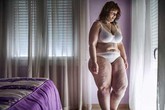 Quá trình giảm 55kg của cô gái nặng 124kg Quá trình giảm 55kg của cô gái nặng 124kg