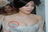 Sao tím cổ, xước ngực vì "yêu" quá đà Sao tím cổ, xước ngực vì "yêu" quá đà
