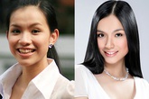 Top mỹ nhân đẹp rạng ngời bàng quan với dao kéo Top mỹ nhân đẹp rạng ngời bàng quan với dao kéo