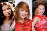 Những thảm họa thẩm mỹ đau lòng trong showbiz Những thảm họa thẩm mỹ đau lòng trong showbiz