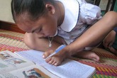 Nghị lực của cô bé có đôi tay "dẹp xương" học giỏi viết bằng chân trái Nghị lực của cô bé có đôi tay "dẹp xương" học giỏi viết bằng chân trái