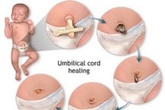 Vệ sinh cuống rốn cho bé Vệ sinh cuống rốn cho bé