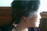 Hãi hùng một phụ nữ bị chó hàng xóm cắn nát mặt Hãi hùng một phụ nữ bị chó hàng xóm cắn nát mặt
