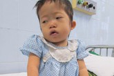 Bé 3 tuổi từng bị bỏ rơi tím tái không thể phẫu thuật được Bé 3 tuổi từng bị bỏ rơi tím tái không thể phẫu thuật được