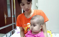 Mắc căn bệnh quái ác, bé gái 21 tháng tuổi bụng to như trống Mắc căn bệnh quái ác, bé gái 21 tháng tuổi bụng to như trống
