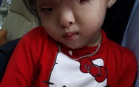 Cô bé 3 tuổi bị dị tật mắt vẫn cần sự giúp đỡ của cộng đồng để tìm ánh sáng Cô bé 3 tuổi bị dị tật mắt vẫn cần sự giúp đỡ của cộng đồng để tìm ánh sáng