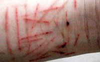 'Nhiều học sinh khá, giỏi có biểu hiện tự hủy hoại bản thân' 'Nhiều học sinh khá, giỏi có biểu hiện tự hủy hoại bản thân'