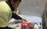 Những hình ảnh xót xa về bé gái dân tộc 12 tháng tuổi bị bỏng nặng vì ngã vào bếp lửa Những hình ảnh xót xa về bé gái dân tộc 12 tháng tuổi bị bỏng nặng vì ngã vào bếp lửa