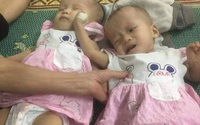 Một con qua đời, một con bị tim lỗi nhịp, đôi vợ chồng trẻ đau khổ trong kiệt cùng túng quẫn Một con qua đời, một con bị tim lỗi nhịp, đôi vợ chồng trẻ đau khổ trong kiệt cùng túng quẫn