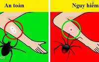 Ba điều bạn cần biết để xử trí trong tình huống cấp bách Ba điều bạn cần biết để xử trí trong tình huống cấp bách