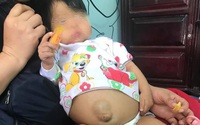 Bé gái 14 tháng tuổi bị xơ gan, bà ngoại bỏ xạ trị ung thư để cứu cháu Bé gái 14 tháng tuổi bị xơ gan, bà ngoại bỏ xạ trị ung thư để cứu cháu