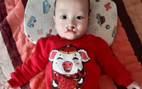 Mất đi hai đứa con, đôi vợ chồng nghèo giờ chỉ mong tìm lại nụ cười cho con trai hở hàm ếch Mất đi hai đứa con, đôi vợ chồng nghèo giờ chỉ mong tìm lại nụ cười cho con trai hở hàm ếch