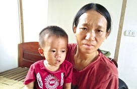 Mong manh cháu bé vướng căn bệnh cả thế giới có 9 ca mắc Mong manh cháu bé vướng căn bệnh cả thế giới có 9 ca mắc