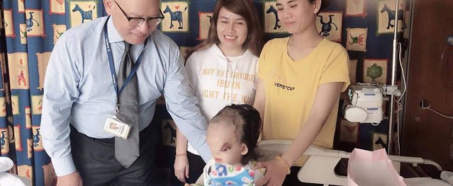 Ca mổ đầu tiên của bé gái 3 tuổi có khuôn mặt biến dạng đã thành công tốt đẹp Ca mổ đầu tiên của bé gái 3 tuổi có khuôn mặt biến dạng đã thành công tốt đẹp