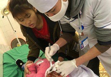دو کودک در لائو کای در اثر حرارت دادن با زغال و هیزم دچار سوختگی شدید شدند - عکس 1.