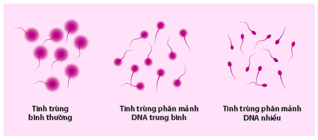 Đau đớn 2 năm mất con tới 4 lần, cặp vợ chồng bất ngờ khi biết nguyên nhân  - Ảnh 1.