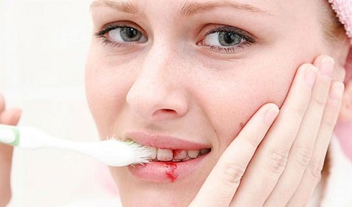 Tuổi mới 30 mà răng “yếu” như người 60: Áp dụng ngay '6 không 4 nên' này để cải thiện sức khoẻ răng miệng của bạn, đập tan nỗi lo lúc về già - Ảnh 1.
