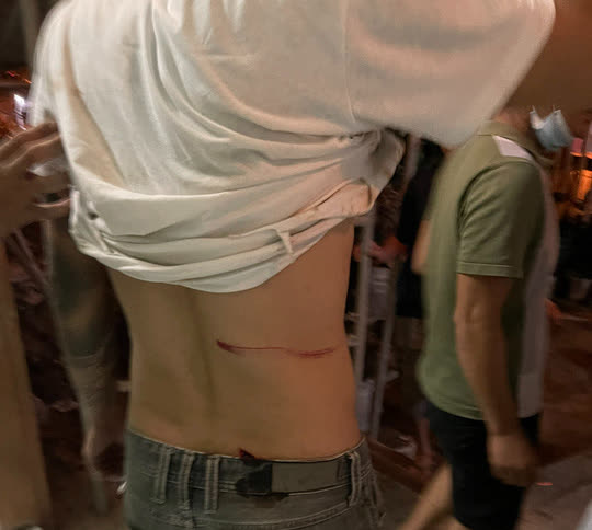 Bị v&acirc;y đ&aacute;nh v&igrave; l&agrave;m vỡ một vi&ecirc;n gạch, nh&oacute;m thợ h&uacute;t hầm cầu đoạt mạng chủ nh&agrave; - Ảnh 2.