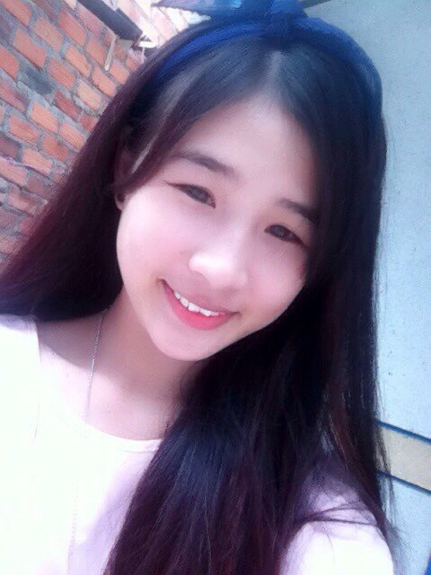 C&ocirc; g&aacute;i B&igrave;nh Thuận bị m&eacute;o miệng, liệt nửa mặt v&igrave; một th&oacute;i quen ăn uống h&agrave;ng triệu người trẻ đang c&oacute;, ngoại h&igrave;nh sau khi can thiệp thẩm mỹ thực sự đ&aacute;ng kinh ngạc - Ảnh 1.