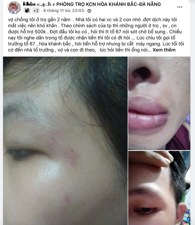 Tin sáng 10/11: Diễn biến mới về dịch COVID-19 ở Hà Nội; thanh niên tố bị đánh ở nhà tổ trưởng khi hỏi tiền hỗ trợ dịch COVID-19  - Ảnh 5.