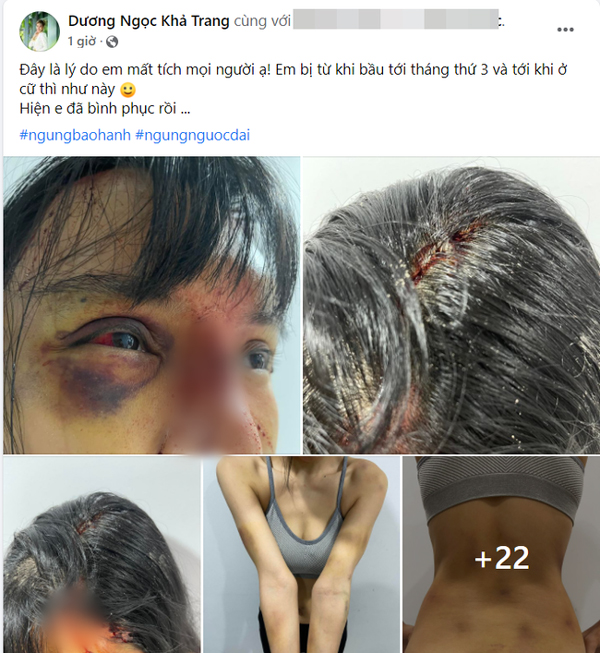 Siêu mẫu Khả Trang công khai mặt mũi bị đánh bầm dập, bạn thân tiết lộ bị chồng đánh - Ảnh 2.