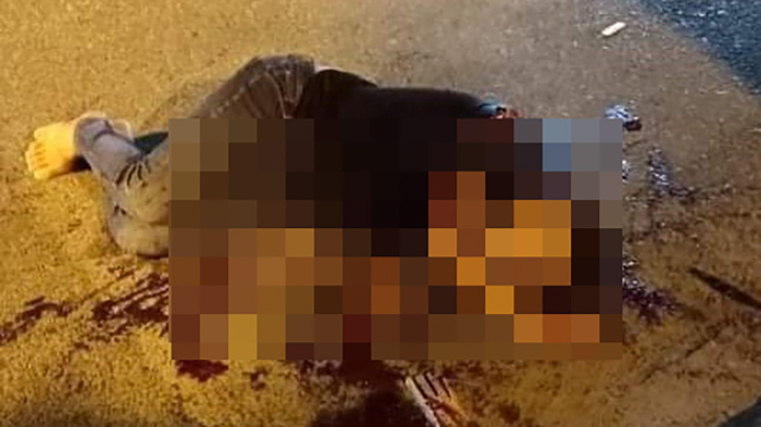 Bắt 5 đối tượng chém đứt lìa bàn tay một thanh niên - Ảnh 3.