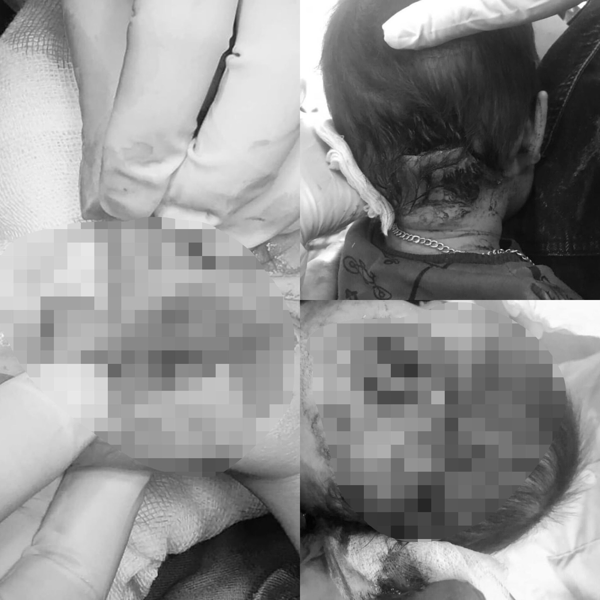 Kinh hoàng chó dữ lao vào tấn công bé trai 2 tuổi ở Tuyên Quang - Ảnh 1.