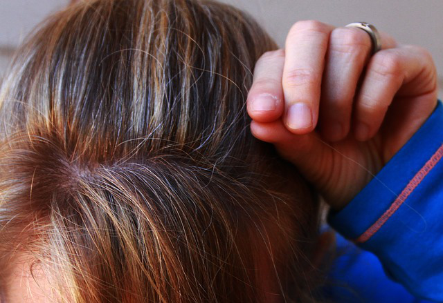 Người trẻ tóc ngày càng bạc sớm hơn: 9 sự thật đập tan các lầm tưởng về tóc bạc - Ảnh 3.