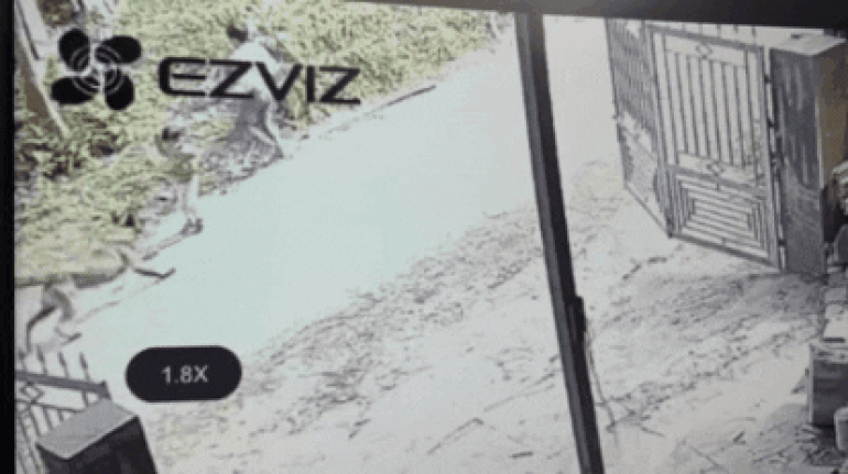 Th&ocirc;ng tin mới nhất vụ b&eacute; 2 tuổi bị ch&oacute; cắn kinh ho&agrave;ng - Ảnh 1.