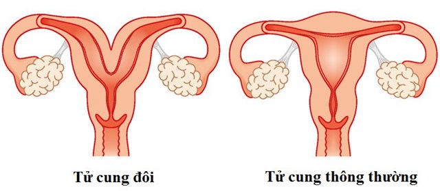 Những người nào dễ bị sảy thai liên tiếp? - Ảnh 3.