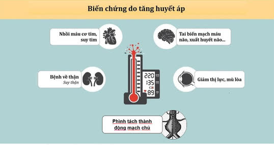 Tăng huyết áp - Căn bệnh nguy hiểm cần hết sức lưu ý - Ảnh 2.